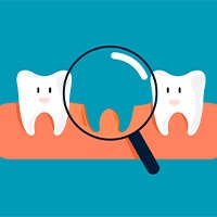 Illustration of two happy teeth looking at a gap between them with a magnifying glass