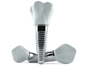 Close-up of three dental implants lying next to each other